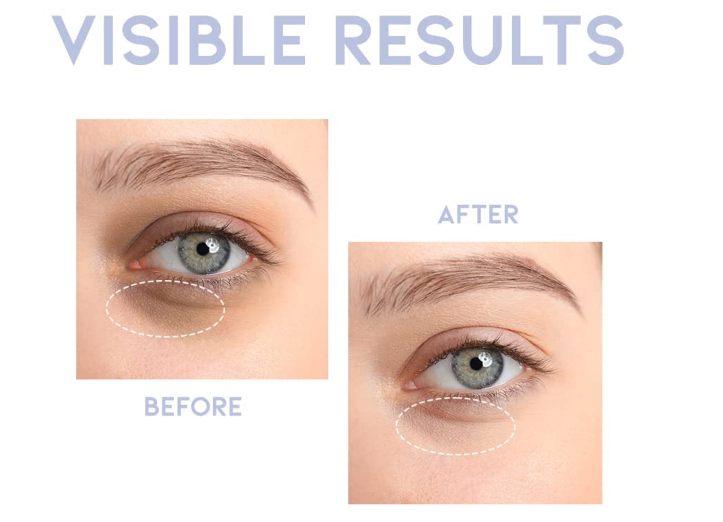 OOTD - Intensive Eye Serum A.M