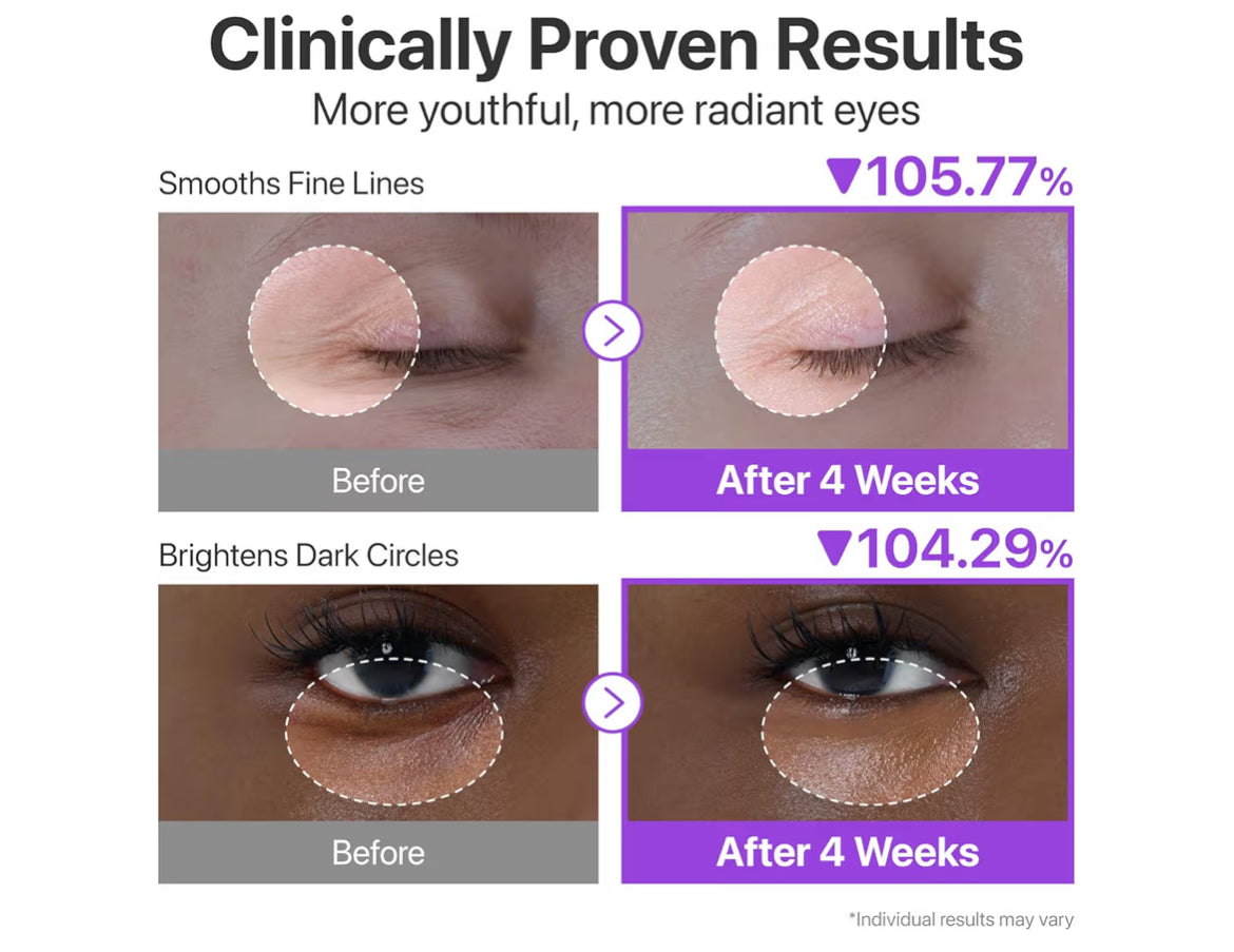 numbuzin No.9 NAD+ Retinol Eye Cream.