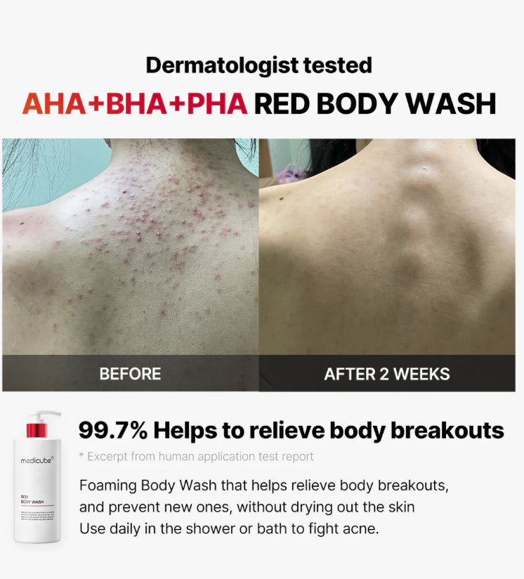 Medicube, RED BODY WASH, 14.10 oz.